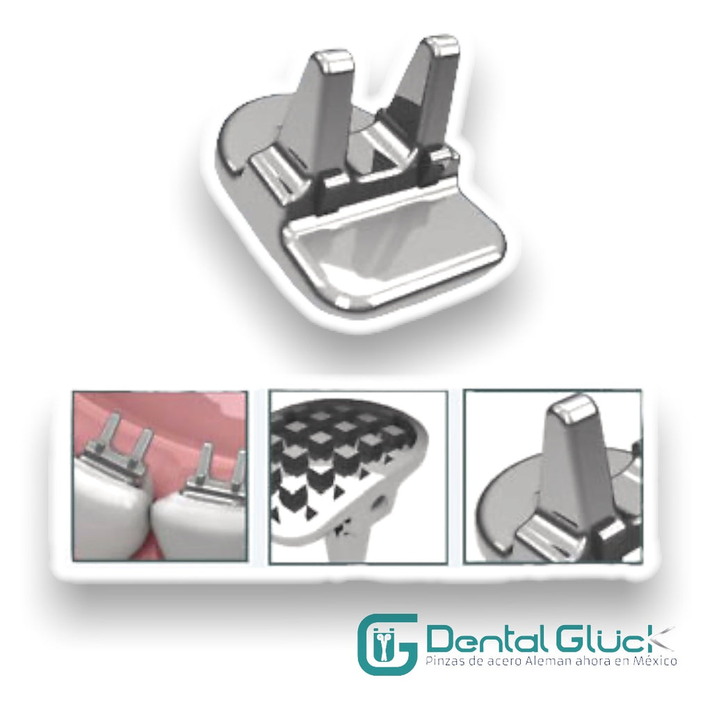 CORRECTOR PARA HÁBITO DE LENGUA SPIKE Dental Glück®