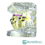 Tipodonto Dental con Brackets y Ortoimplantes  Material: Acrílico transparente. Calidad Premium.