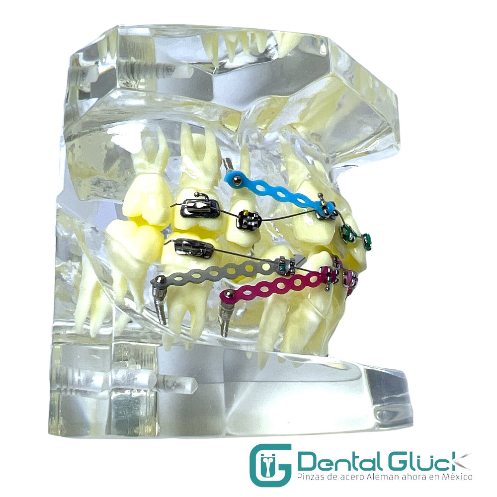 Tipodonto Dental con Brackets y Ortoimplantes  Material: Acrílico transparente. Calidad Premium.