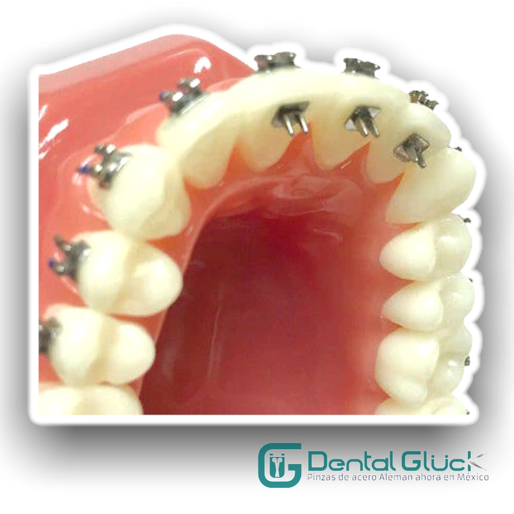 CORRECTOR PARA HÁBITO DE LENGUA SPIKE Dental Glück®