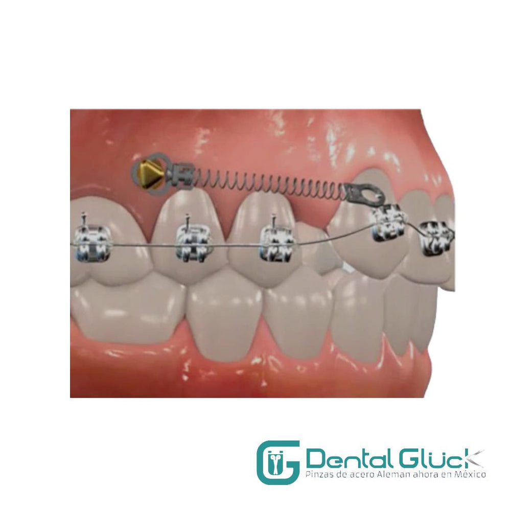 Close Coiled Spring CLOSE COIL (SPRING) EYELET – Dental Glück®